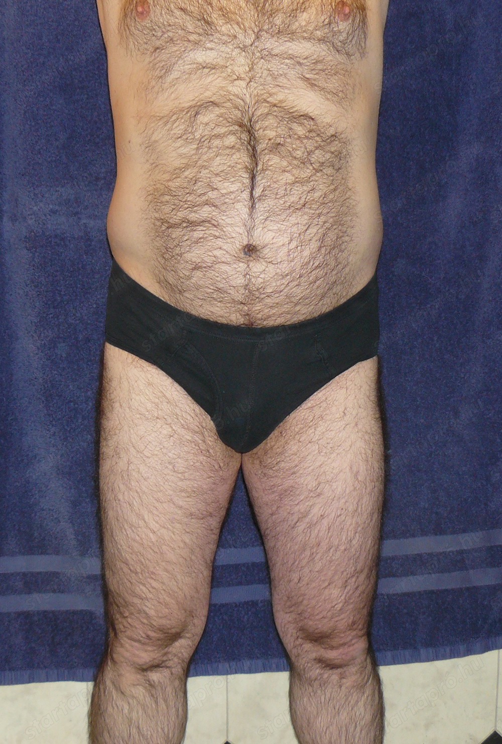 Hölgy partnert keresek 