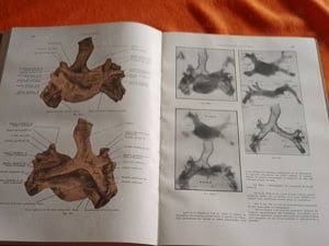 Les Fondements Anatomo-radiologiques de L'Investigation Pulmonaire (A tüdő anatómiai vizsgálata - fr - kép 10