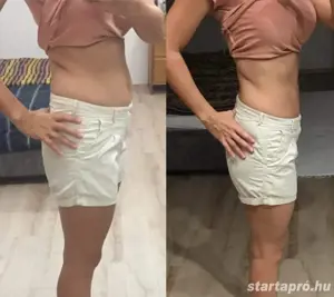 alakformalas zsirbontas 