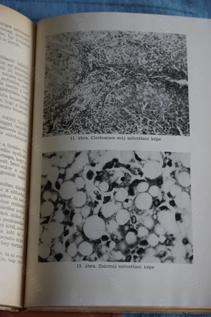 A Gyakorló Orvos Könyvtára Medicina Könyvkiadó 17 db könyv - kép 6