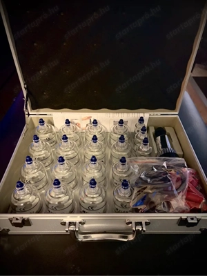 Masszázságy és köpölykészlet eladó! - kép 2