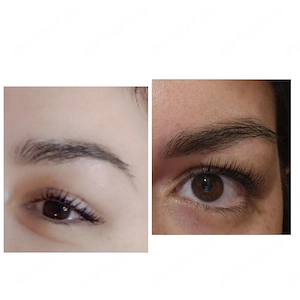 Lifting és laminálás  - kép 2